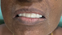 Dr Naga's White Dental Clinic - Implants | Aligners | Root canal treatment