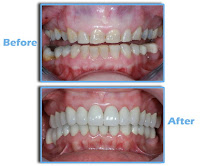 First Dent Dental Clinic