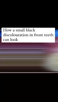 Srivi Dental Care Clinic & Implant Centre In Adyar
