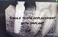 Dr.Mohana's Dental Care