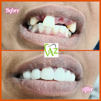 Sri A2Z Dental clinic - Best dentist in OMR