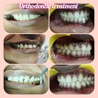 Sri A2Z Dental clinic - Best dentist in OMR