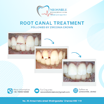 NEOSMILE DENTAL AND IMPLANT CENTRE | INVISIBLE ALINGNERS | SMILE DESIGN| 3D SCANNING