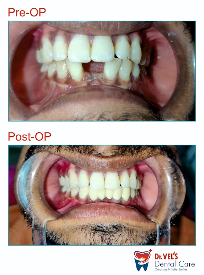 Drvels Dental Care dental clinic