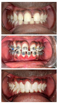 DR.VELS DENTAL CARE