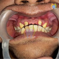 S.R. FAMILY DENTAL CLINIC - BEST IMPLANT CLINIC IN CHENNAI | BEST DENTAL ALIGNERS IN CHENNAI