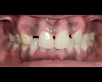 Velachery Vijaya Dental Rehabilitation Centre | IIT Madras Campus Backside | Vijaya Implants & Aligner Centre | Top Dentist