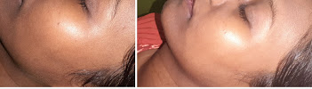 D- Care Dental, Skin & Hair Cosmetic Clinic