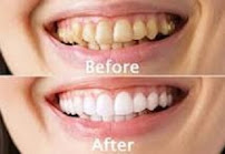 Aarthi Priyas Tooth Care Clinic