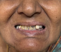 Smile Care Dental Centre