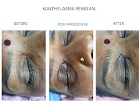 Dr. Perumal. M, Skin specialist