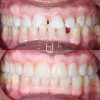 Unique Dental Clinic - Cabo San Lucas