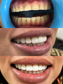 GS Dental in Cabo San Lucas