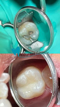 Dental San Lorenzo