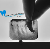 Dental San Lorenzo