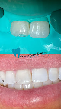 Dental San Lorenzo