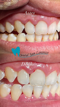 Dental San Lorenzo