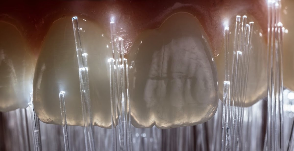 Dental Excellence