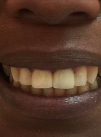 Dental Excellence