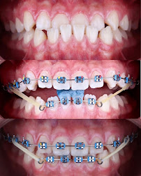 Dental A&S .Dra. Susana Sánchez