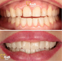 Dental A&S .Dra. Susana Sánchez