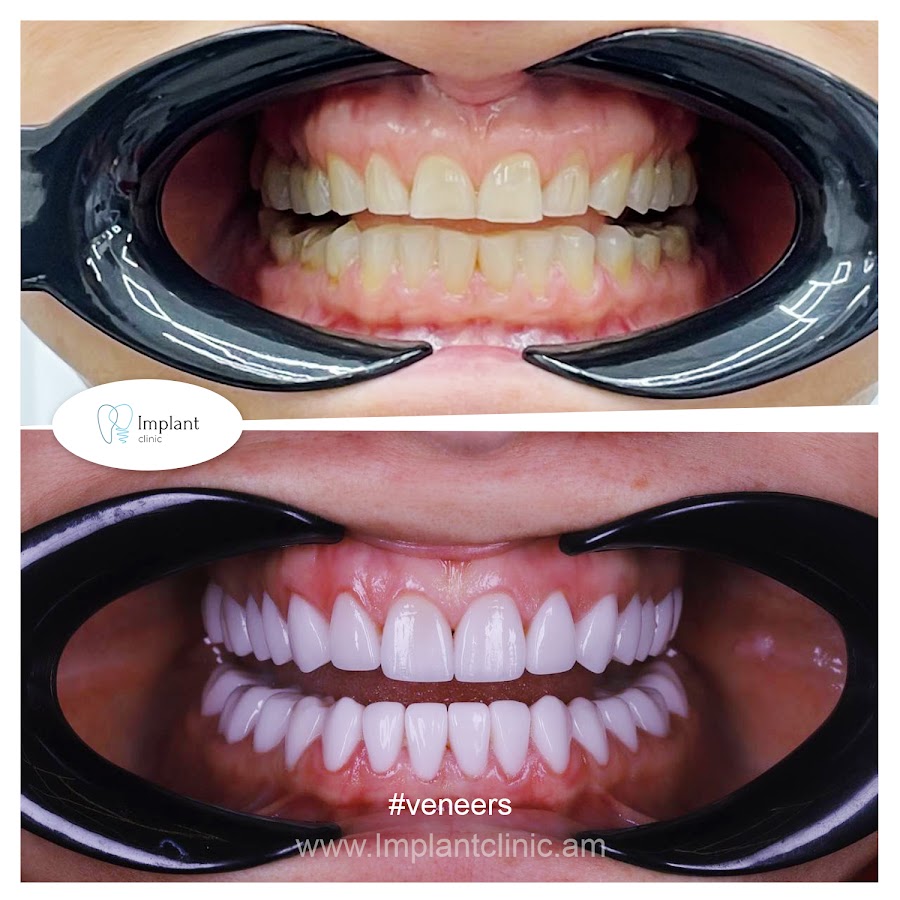 Implant Clinic dental clinic