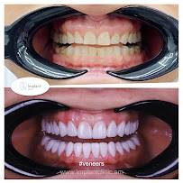 Implant Clinic