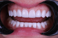 Implant Clinic