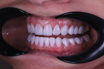 Implant Clinic
