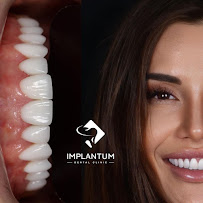 IMPLANTUM Dental Clinic