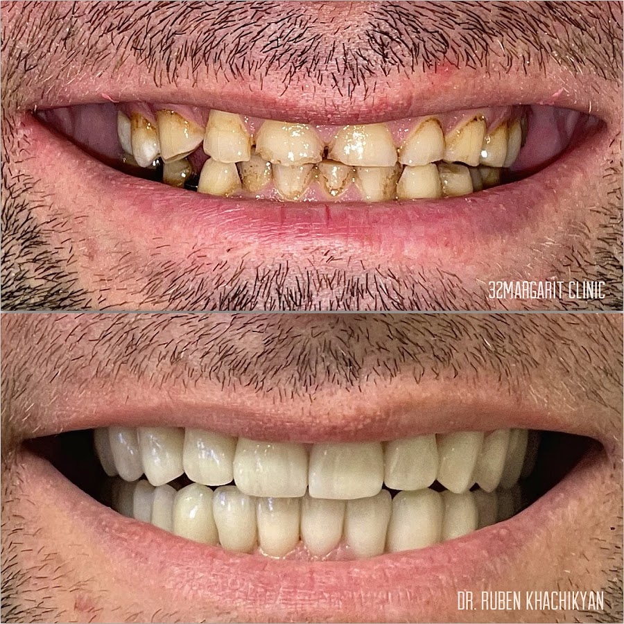 32 ՄԱՐԳԱՐԻՏ dental clinic