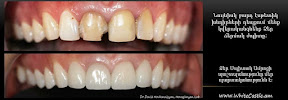 Սպիտակ Ամրոց ստոմատոլոգիական կլինիկա / White Castle dental clinic / Стом. Клиника Белая Крепость