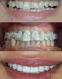Dental Elegance