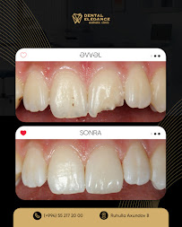 Dental Elegance