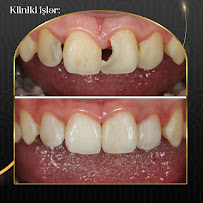 Dental Elegance