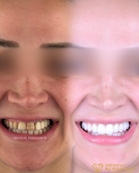 Dental Elegance
