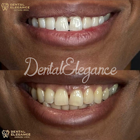 Dental Elegance