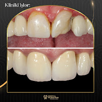 Dental Elegance