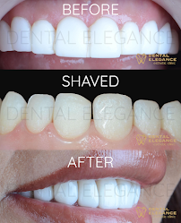 Dental Elegance