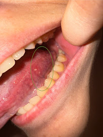 Smile by Dr Bakhtiyar