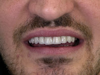 Vlore "Tozaj"