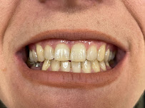 Gaya American Dental