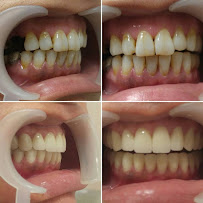 İstanbul Dentestetik Diş Polikliniği Kadıköy