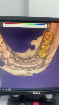Mela Dent