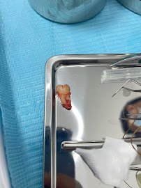 Dentistry France Vietnam Hue