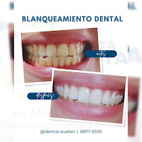 Clínica Dental Santa Ana Dra. Mónica Gutiérrez Pereira