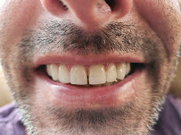 Star Dental Implant Center