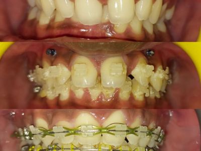 Dr. Khushboo Dent house dental clinic in Mumbai, India, photograph 15