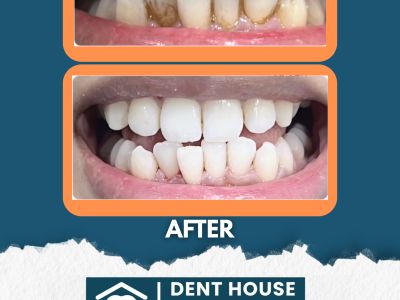 Dr. Khushboo Dent house dental clinic in Mumbai, India, photograph 18