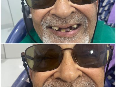 Dr. Khushboo Dent house dental clinic in Mumbai, India, photograph 7